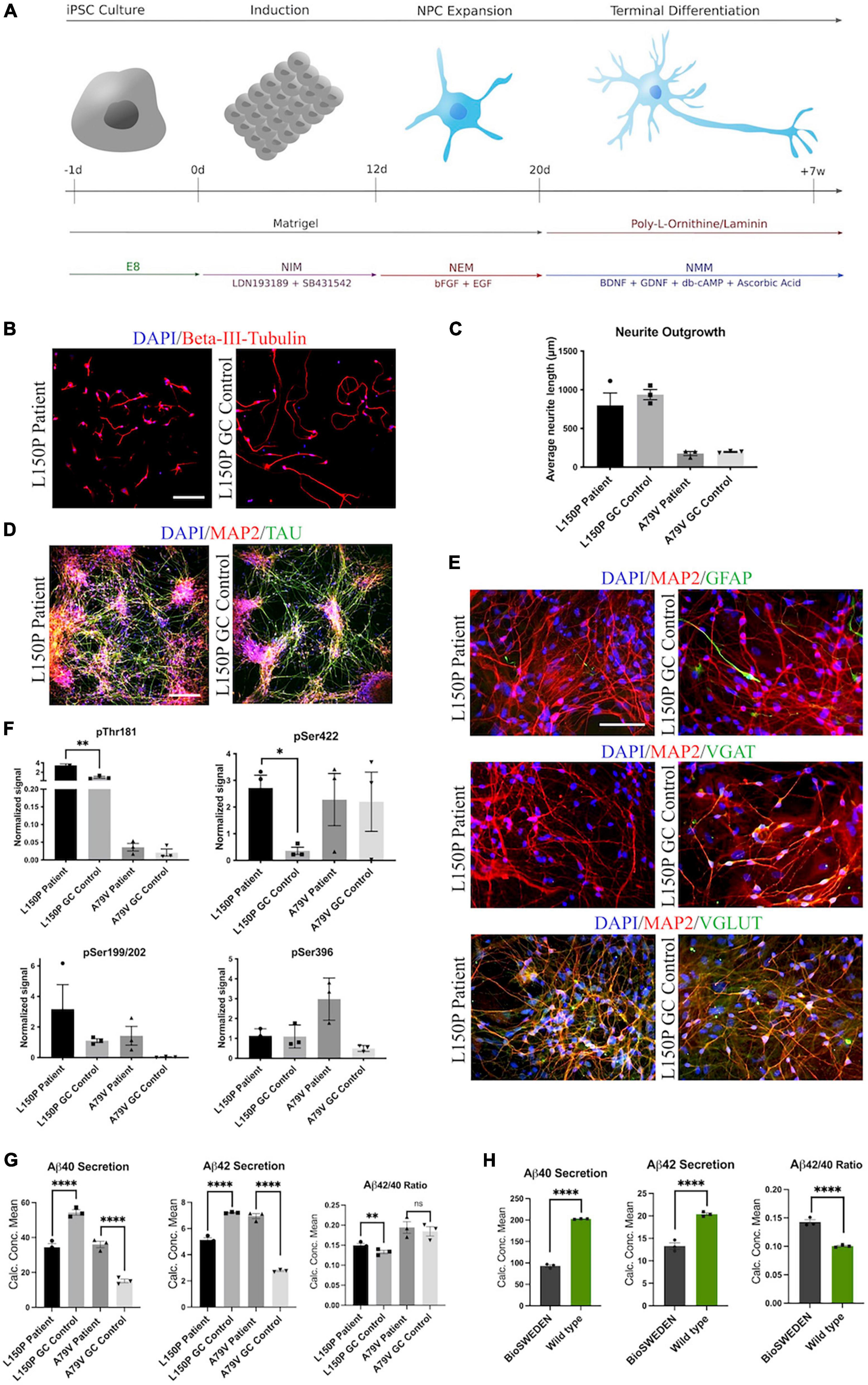 Golgi fragmentation – One of the earliest organelle phenotypes in Alzheimer’s disease neurons